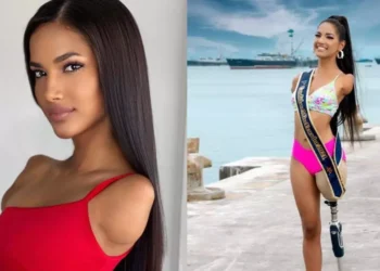 Victoria Salcedo este model fără mâini și fără un picior! Reacția tinerei: ”Viața continuă, indiferent de situație”