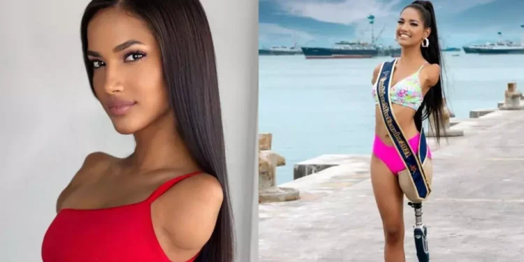 Victoria Salcedo este model fără mâini și fără un picior! Reacția tinerei: ”Viața continuă, indiferent de situație”